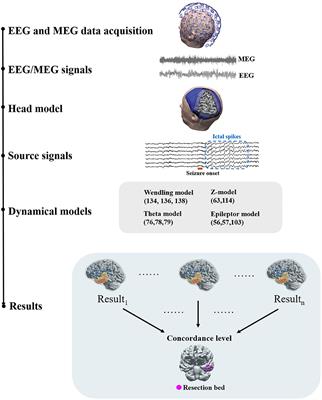 Dynamical Network Models From EEG and MEG for Epilepsy Surgery—A Quantitative Approach